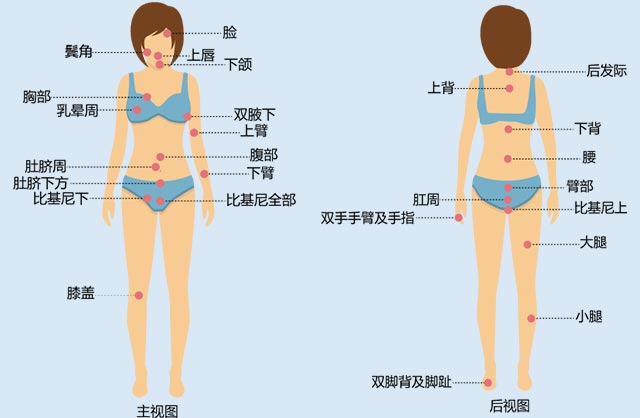 脱毛部位视图